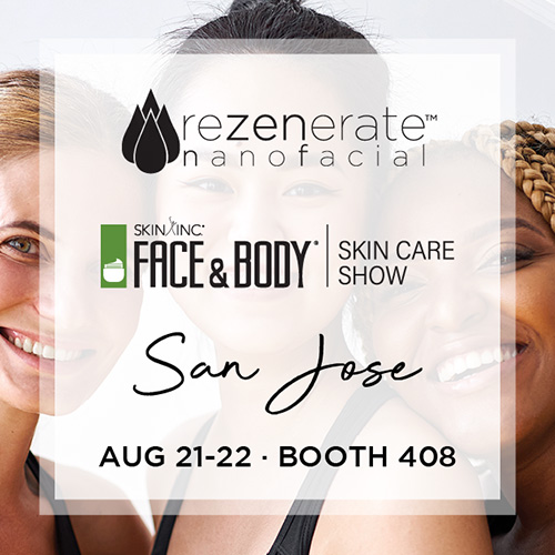 Rez San Jose